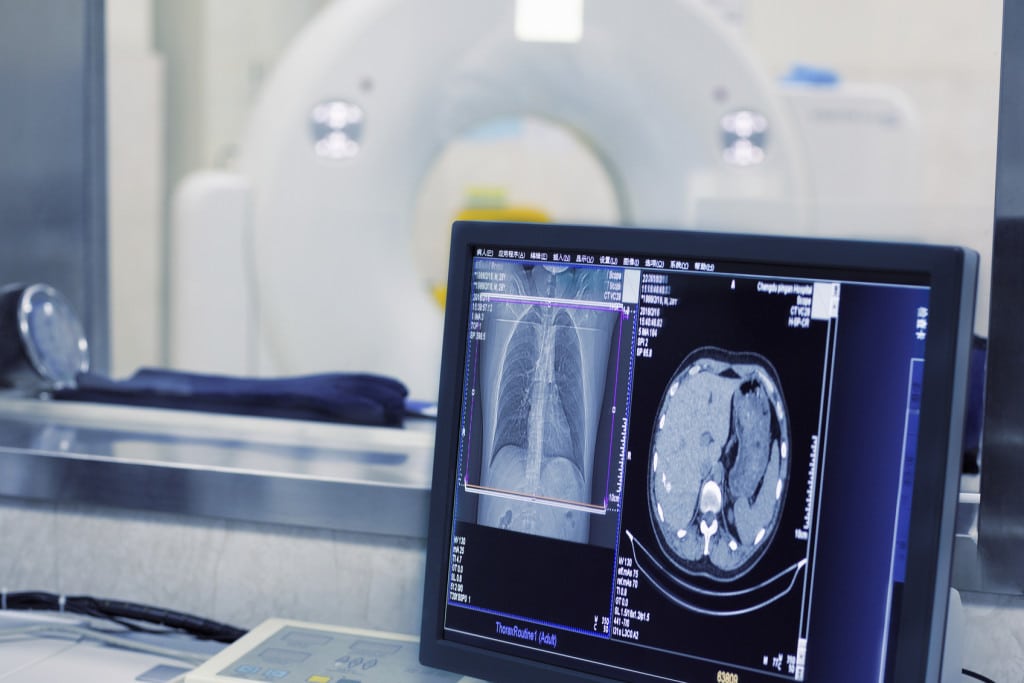 What You Can Do To Prevent Traumatic Brain Injuries