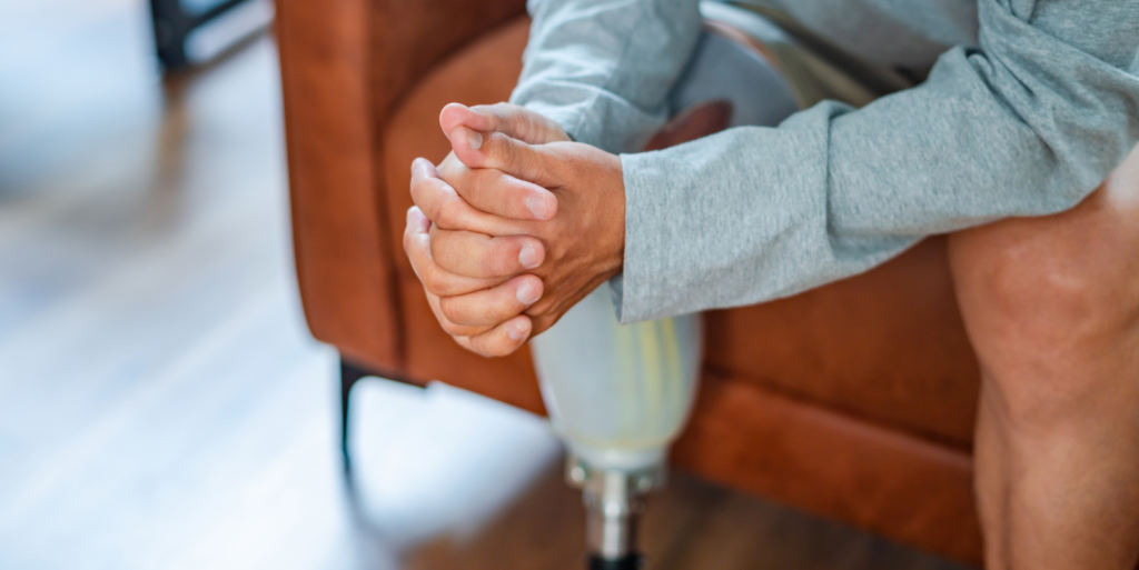 What Compensation Is Available for Amputation Victims?
